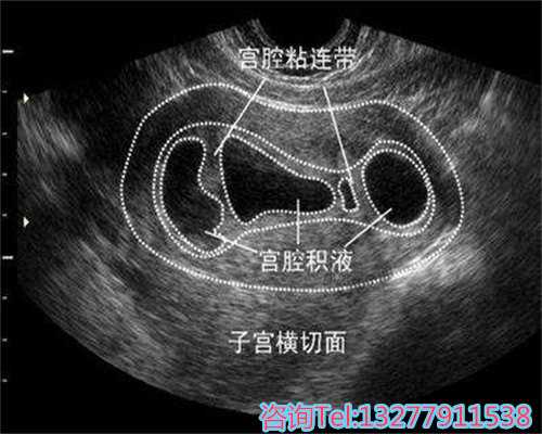 试管宝宝提前降临的历程分享
