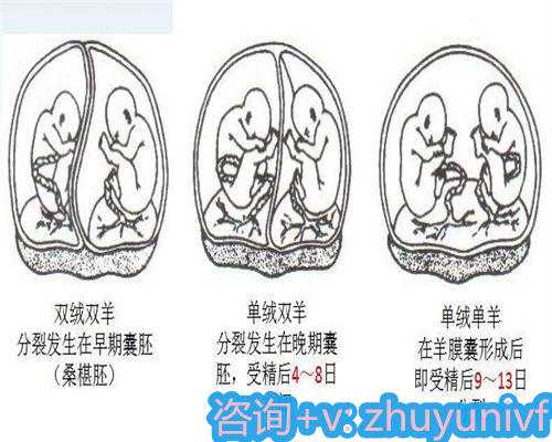靠谱高效哪里需要供卵助孕孩子的指南